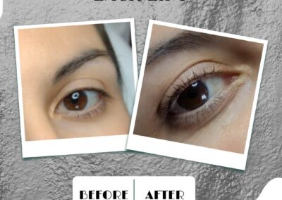 Lash lift